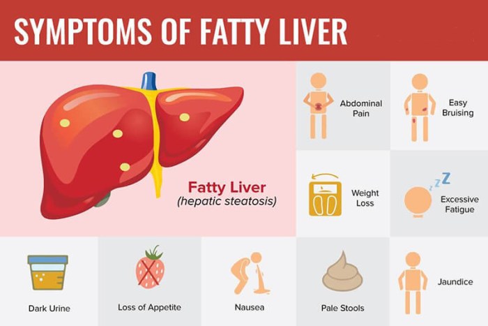 Official Symptoms Of Liver Disease Guide - Alcoholic And Non-Alcoholic ... Official Symptoms Of Liver Disease Guide - Alcoholic And Non-Alcoholic ...